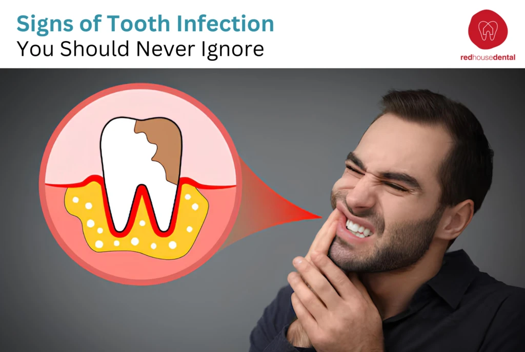 Signs of tooth infection article - Red House Dental Richmond Hill
