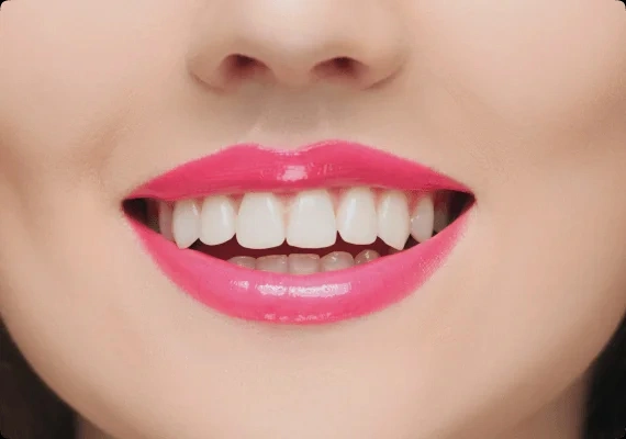 After dental treatment results at Red House Dental Richmond Hill