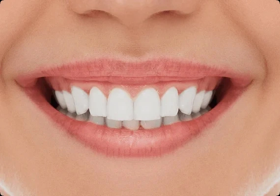After smile makeover results at Red House Dental Richmond Hill