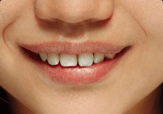 Before dental treatment at Red House Dental Richmond Hill